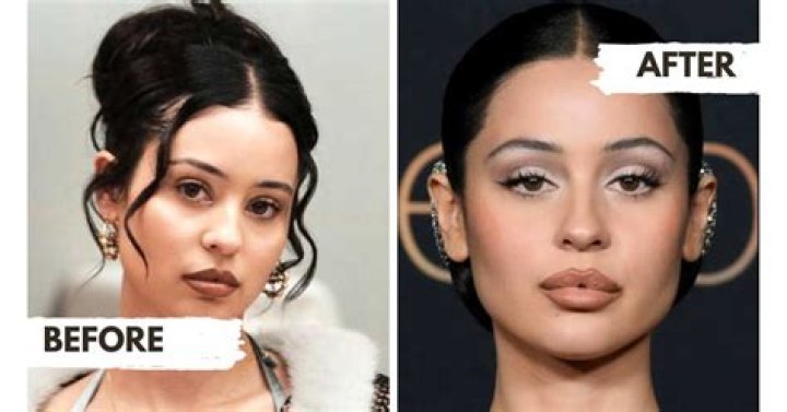 Alexa Demie before and after surgery ·