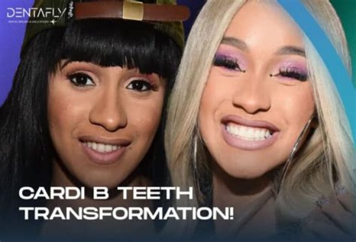 Cardi B Teeth Then And Now