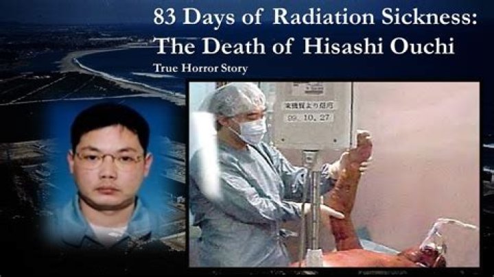 Exclusive Hisashi Ouchi Photos: A Tragic Reminder Of The Dangers Of Radiation