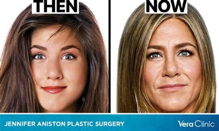 Jennifer Jason Leigh Botox And Nose Job Plastic Surgery Before And After ·