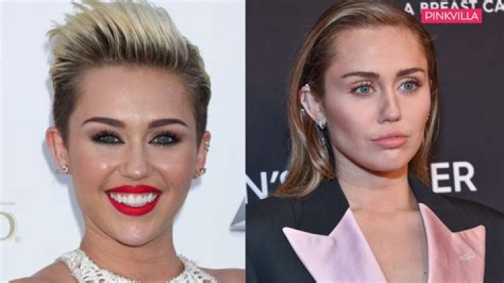 Miley Cyrus Buccal Fat Removal: Before And After Photos