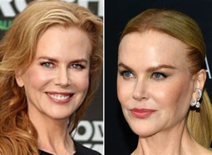 Unraveling The Truth: Does Nicole Kidman Have An Eating Disorder?