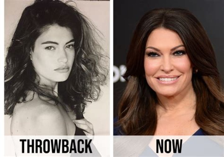 Unveiling Kimberly Guilfoyle's Transformation: Before Surgery Insights