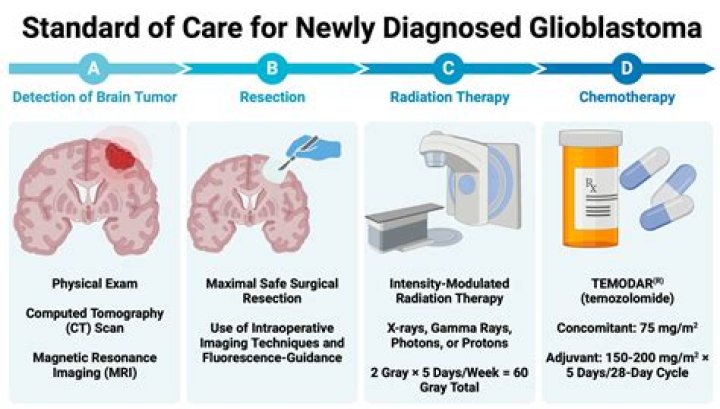 Was Sarah Jakubasz Glioblastoma Linked To Death