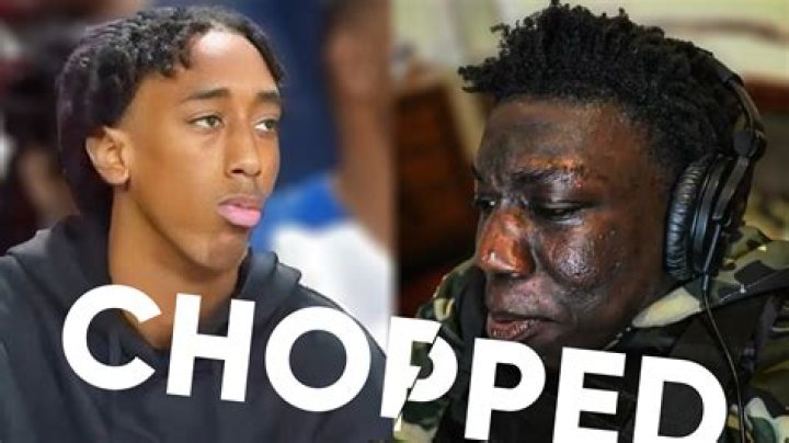 What Happened to Dabo Swinney's Eye? How Did Dabo Swinney Get a Black Eye? ·