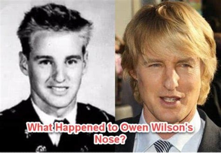 What Really Happened To Owen Wilsons Nose And How Did He Break It?